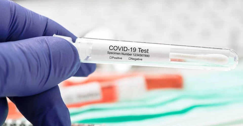 Türkiye’ye girişlerde koronavirüs test zorunluluğu kaldırıldı